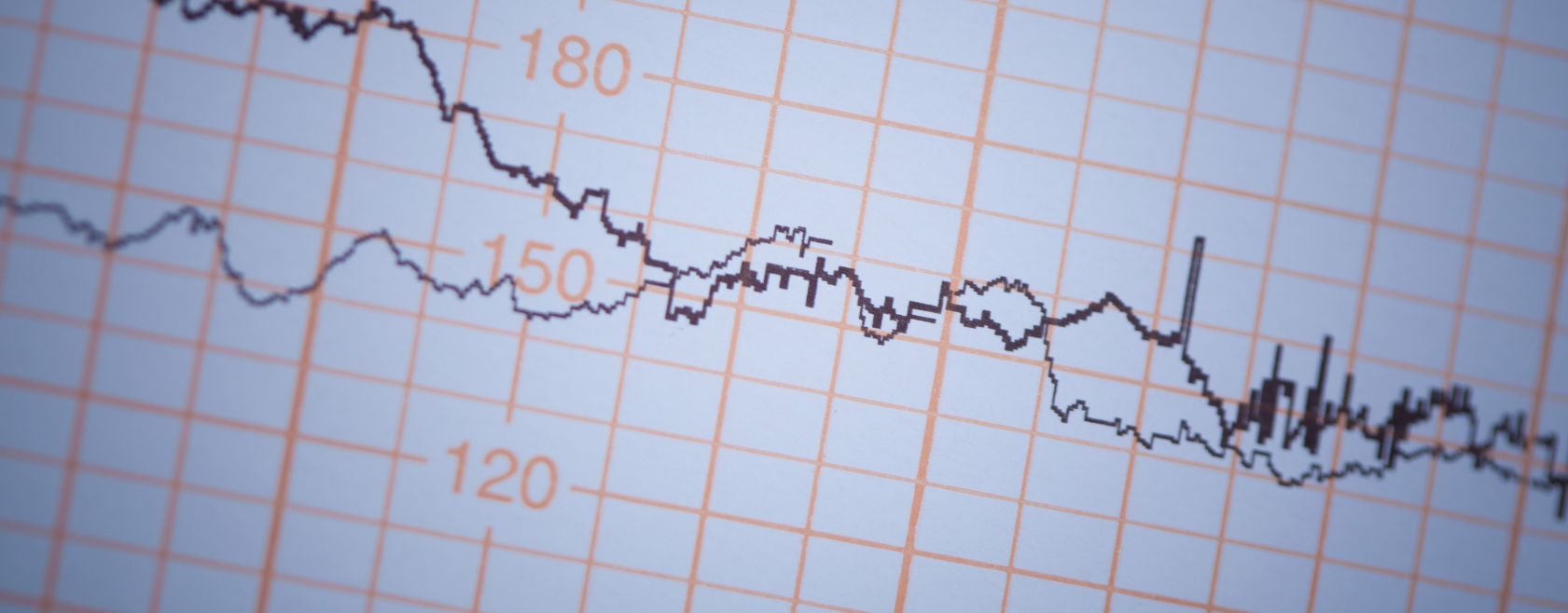 AI stress testing helps companies navigate tariff chaos through real-time scenario analysis and mitigation.